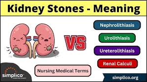 Image result for Nephrolithiasis