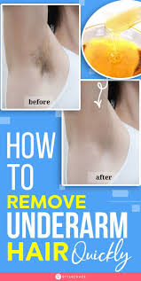 Keep your underarms clean by removing dirt, oil, and grime regularly. How To Remove Underarm Hair In Just 2 Minutes Simple Natural Solution How To Remove Underarm Hair Natural Hair Removal Underarm Hair
