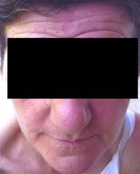 Image result for Harlequin Color Change