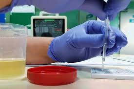 Products like quick fix, monkey whizz, number 1, synthetix5, jet, whizzkit, monkey dong, whizzinator. Urine Drug Screen Uses Procedure Detection Times And Results