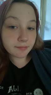 Piercing after wisdom teeth removal: risks and timing?