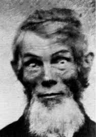 Hirsch Caleb W MD, 23101 Sherman Pl, Ste 500, West Hills, CA 91307, US