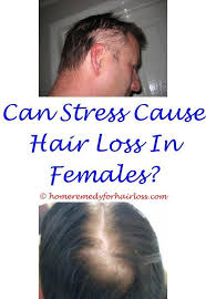 Hair loss or thinning of the hair inability to have or keep an erection leg cramps loss in sexual ability, desire, drive, or performance pain in the nipples sores, welts, or blisters stomach upset swelling of the breasts or breast soreness in both females and males unusual dullness or feeling of sluggishness Pin On Hair Loss