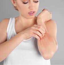 Integrating Mind-Body Therapies to Improve Outcomes in Atopic Dermatitis