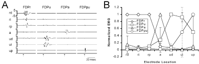 Flexor digitorum profundus is a composite muscle innervated by the anterior interosseous nerve and ulnar nerves. Tension Distribution To The Five Digits Of The Hand By Neuromuscular Compartments In The Macaque Flexor Digitorum Profundus Journal Of Neuroscience