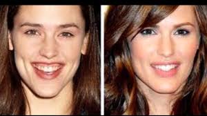 Jennifer garner alias jen garner jennifer garner body jennifer aniston beautiful celebrities most beautiful women beautiful legs jennifer nicole lee hot brunette. Jennifer Garner Plastic Surgery And Frozen Face Trying To Keep Looking Young Youtube