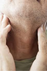 Ever feel like there is something lodged in your throat — even though you know there isn't? Sore Throat On One Side 9 Causes And When To See A Doctor