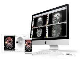 We did not find results for: Osirix Dicom Viewer The World Famous Medical Imaging Viewer