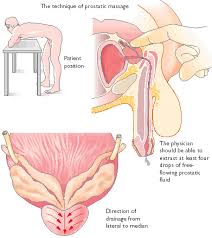 Prostate stimulation and massage is beginning to lose some of the stigma and negativity that has surrounded it for many years. Prostate Massage For Medical Purposes Prostate Health Center