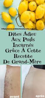Qui N A Pas Du Faire Face A Ces Poils Qui Repoussent Sous La Peau Apres Une Epilation Creant A Leur Pass Ingrown Hair Best Hair Removal Products Hair Removal