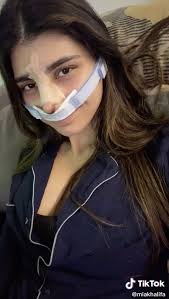 Here's what you need to know about which ones to try and how they stack up to other ha dermal fillers. Madison Beer Responds To Cosmetic Surgery Allegations