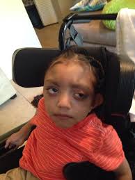 Cerebral Palsy Family Network