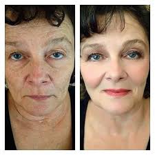 I Have No Words This Before And After Is Amazeballs All Younique Glorious Primer Mineral Touch Pre Younique Makeup Foundation Liquid Foundation
