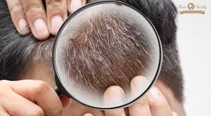 Un tono que debe inclinarse a un resultado muy natural, pero ¡ojo! El Tinte Semipermanente Dana El Cabello Lifehacks De Luisa Olvera