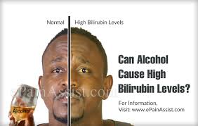 Can Alcohol Cause High Bilirubin Levels