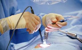 Spine Surgery