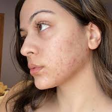 TOP 10 BEST Dermatology near Forest Hills, Queens, NY