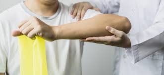 Image result for Muscle Weakness