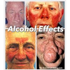Effects Of Alcohol On The Body The Science Of Eating Effects Of Alcohol Alcohol Effects On Body Alcohol