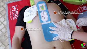 O ator foi transportado para o hospital amadora sintra, onde se encontra a ser observado. O Que Fazer Numa Paragem Cardiorrespiratoria Em Contexto Covid 19 Youtube