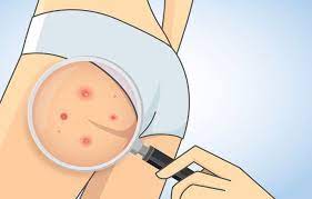 Pin En Mujer Salud Belleza