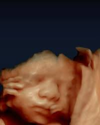 ✨ Sim, é possível ver o rostinho do seu bebê antes mesmo do nascimento., O  Ultrassom 3D/4D transforma esse momento em uma experiência emocionante,  afetiva e inesquecível., 💙 Além da conexão com o ...