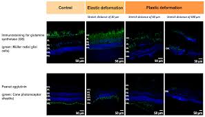 It's been used, but has years of life left in it yet. Ijms Free Full Text Employing Nanostructured Scaffolds To Investigate The Mechanical Properties Of Adult Mammalian Retinae Under Tension Html
