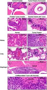 Oncotarget Characterization Of Ips87 A Prostate Cancer Stem Cell Like Cell Line Eurekalert Science News