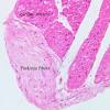 Learn about pacemaker cells with free interactive flashcards. 1