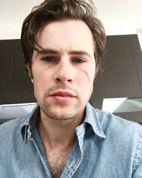 David Berry On Instagram 2 Years Ago I Had A Premalignant Mole Removed From My Face Yesterday I Had To Go And H Lord John Grey Outlander Lord John Outlander