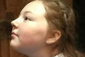 Fundraising swim will help raise awareness of rare disease which claimed  life of Heysham teen