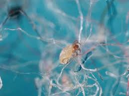 Image result for Dust mite