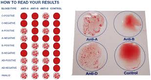 Blood Typing Blood Type Chart Ab Blood Type Blood