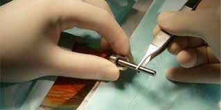 Implantable Drug Delivery System Electronics For You