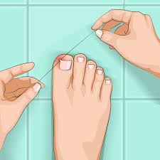 Check spelling or type a new query. 9 Effective Ways To Fix Ingrown Toenails