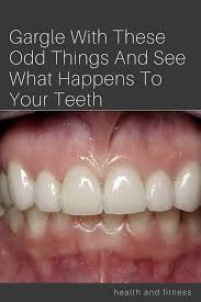 Gargle With These Odd Things And See What Happens To Your Teeth Health And Fitness Tips Good Health Tips Fitness And Beauty Tips