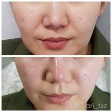 Добрый день, дорогие подписчики 🙂 Сегодня хотим начать знакомить вас с  деятельностью медицинского центра и с нашими докторами 👩🏻‍⚕️👨🏻‍⚕️  Разрешите вам представить 🤗 👩🏻‍⚕️ Молдахметова Жанат Салыковна  Врач-невропатолог, стаж работы 34 года.