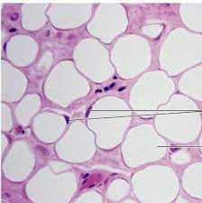Adipose Tissue Adipose Tissue Adipose Tissue