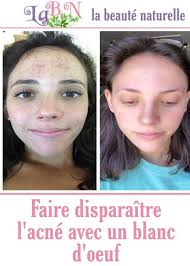 Pin On Masques Visage