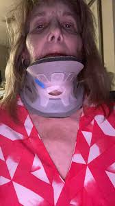 Fundraiser by Andrea J. Feinberg : Support Andrea's Urgent Correcticve  Surgert