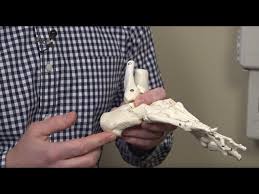 Heel Pain From Plantar Fasciitis And How To Treat It Youtube