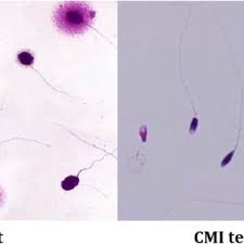 Learn diselang seli in english translation and other related translations from malay to english. Pdf Reactive Oxygen Species Induced Alterations In H19 Igf2 Methylation Patterns Seminal Plasma Metabolites And Semen Quality