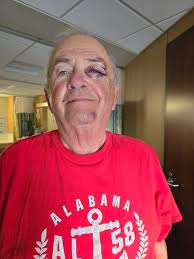 Gerry Buchheit's Aviation Accident Recovery