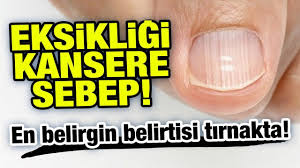 Eksikligi Kanser Sebebi Cinko Nelerde Bulunur Cinko Eksikligi Belirtileri Nelerdir Youtube Saglik Egitimi Doktorlar Saglik