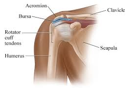 Image result for Frozen Shoulder