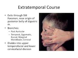 Facial nerve traumatic injury and repair