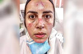 Veja mais ideias sobre enfermeira desenho, enfermagem, enfermeira. Enfermeira Da Rede Ebserh Emociona Com Depoimento Sobre O Cotidiano Do Enfrentamento A Covid 19 Ebserh