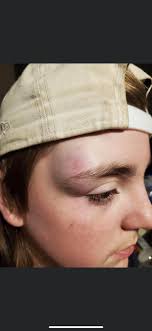 Assault and Hit-and-Run Incident