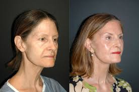 This video was shot by @petrides.art with whom I have been working