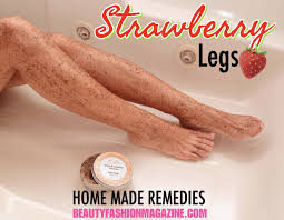 Strawberry Legs Home Remedies To Get Ride Of Them In 2020 Strawberry Legs Exfoliate Legs Exfoliating Body Scrub Diy